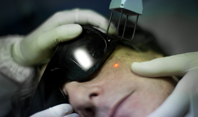 Che lavare vestiti a dermatite atopic