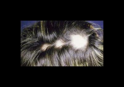 La maschera più efficace di rinforzo di capelli