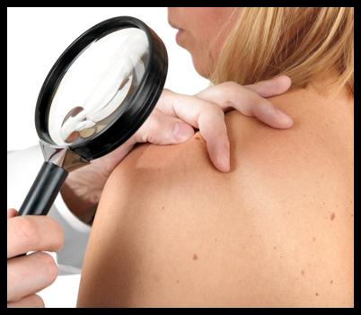 Maschera per capelli da latte e oli