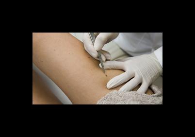 Quanti la maschera per capelli da gelatina tiene
